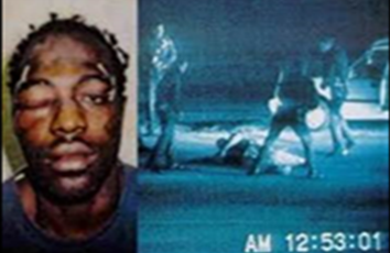 Rodney King and Police Assault